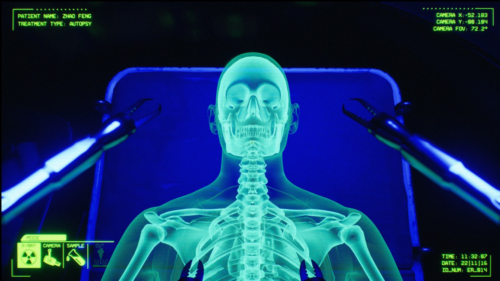 《消极氛围:急诊室》steam抢测开启 恐怖医疗模拟