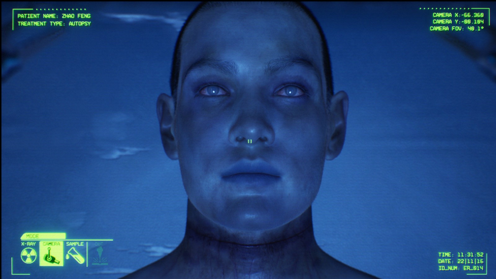 《消极氛围:急诊室》steam抢测开启 恐怖医疗模拟