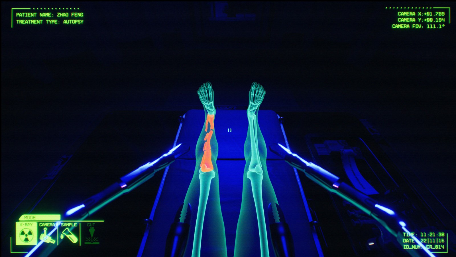 《消极氛围:急诊室》steam抢测开启 恐怖医疗模拟